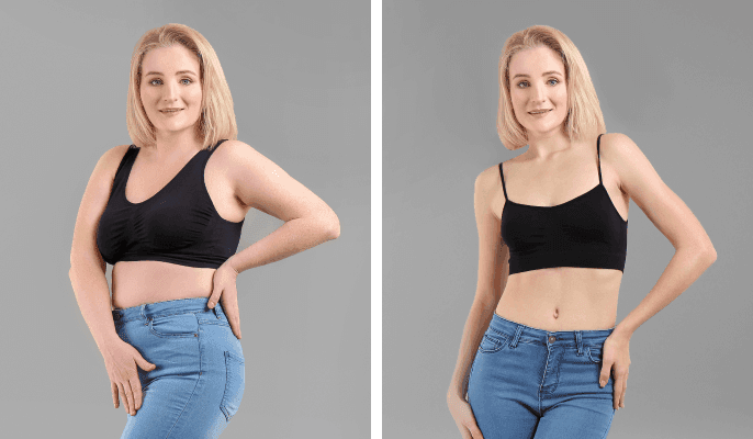 Woman before and after weight loss